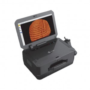 /oct-lmaging-system-product/